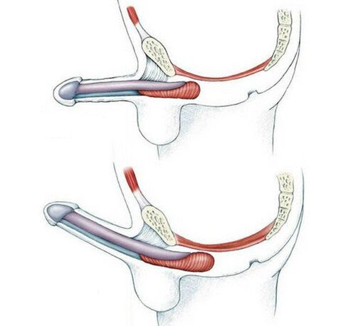 آلت تناسلی بدون آموزش عضله pubococcygeus و بعد از آن